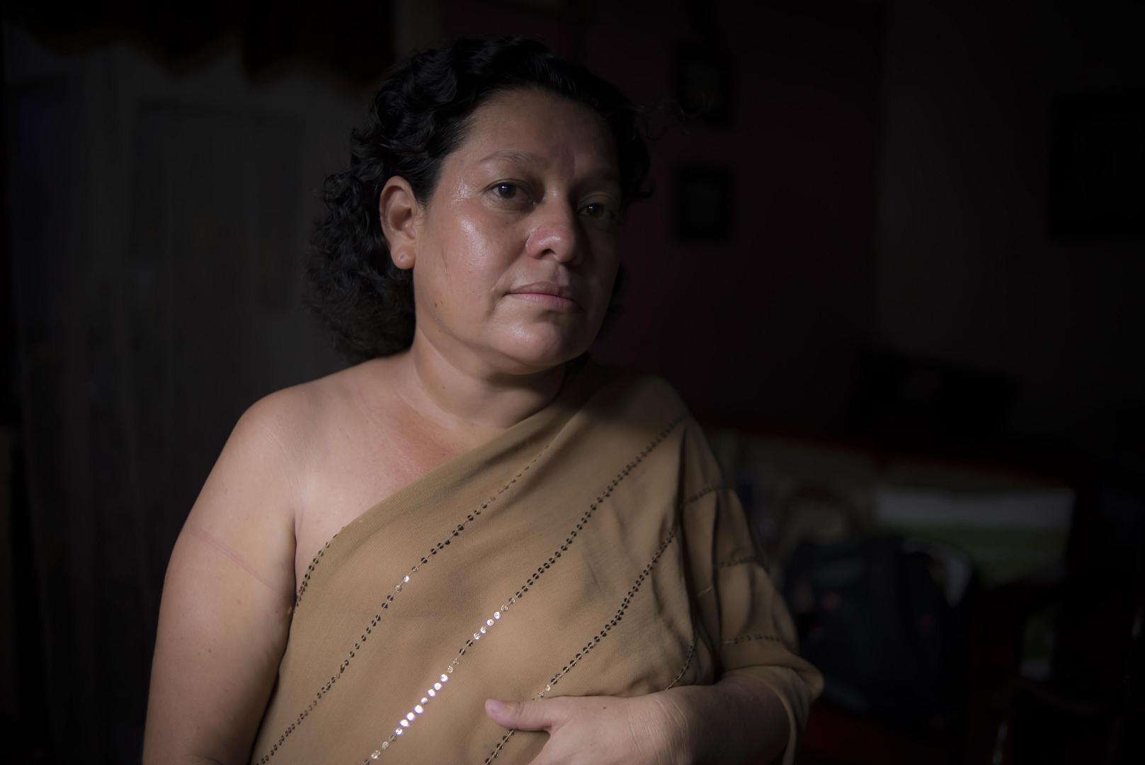 Nicaragua: Cáncer de Mama
