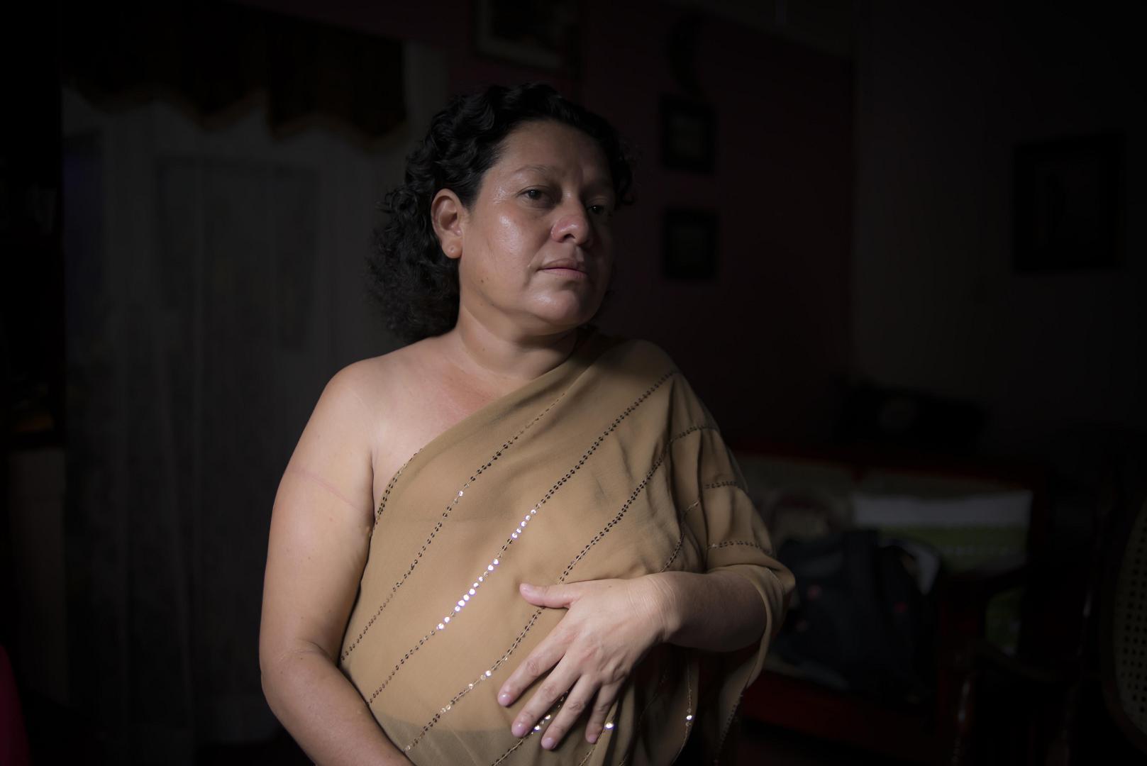 Nicaragua: Cáncer de Mama