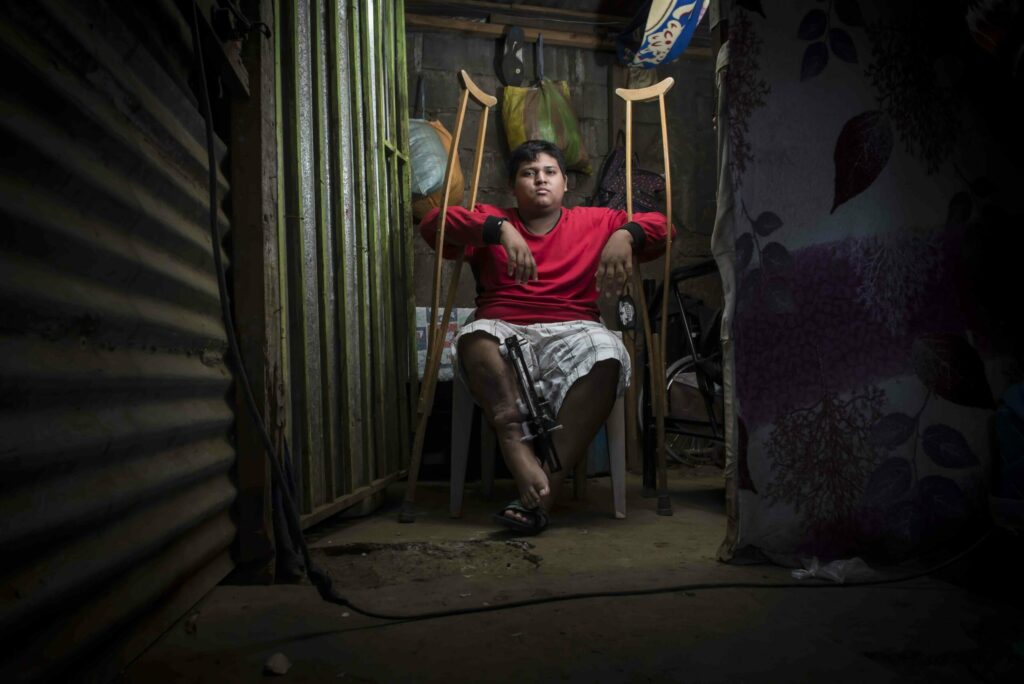 Nicaragua: Lisiados de Abril 2018